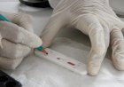 MS registra 275 novos casos de covid na primeira semana epidemiológica do ano