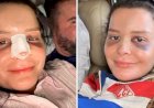 Maraisa mostra nariz quebrado após acidente em hotel: ‘Momentos conturbados’