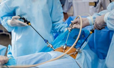 SES amplia acesso à cirurgia bariátrica em MS com triagem criteriosa e novas referências
