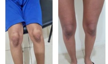 Mãe e madrasta são presas por tortura contra adolescente e criança em Coxim